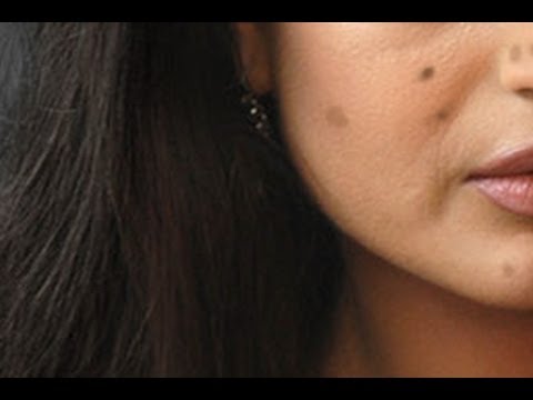 how to get rid of brown age spots