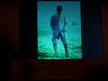 25.Zeynep Kamil Jineko-patoloji kongresinde Tjod Baskani Prof.Dr.Bülent Tıraş'ın konuşması