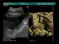 Shimadzu 4D Ultrasound exam