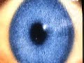 intro