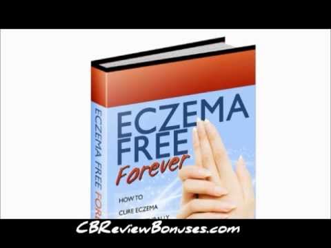 how to stop eczema itching naturally