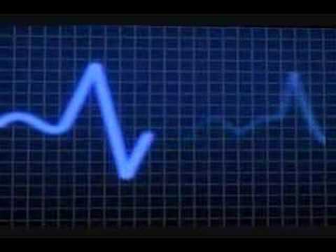 Improved Heart Pulse Meter