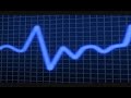 Improved Heart Pulse Meter