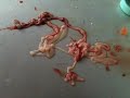 Tapeworm!