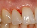 Studio dentistico Frascella - Istruzioni di Igiene Orale