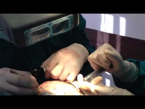 how to know when to transplant