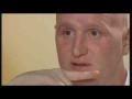 John Hartson || Fighting For My Life || 2*2 || HQ