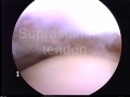 Arthroscopy: Inside the Shoulder by Ford Qureshi