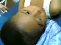 nursing: head wound