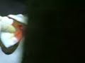 nursing: head wound