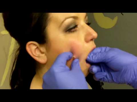 Brett Perkins teaches Roy about Dimple Piercings