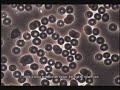 This is a video of Dr Vega's research on Goji. This is amazing proof that when taken in the right amounts, goji takes effect within 48 hours.