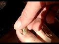 The Toenail The Toenail