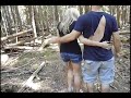 Hombre Cae Desde un Arbol