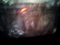 Lag Swtich Match GB