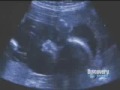discovery channel o guia completo da gravidez   parte 03/05
