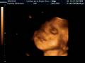 videos de THOMAS 16 LIVE