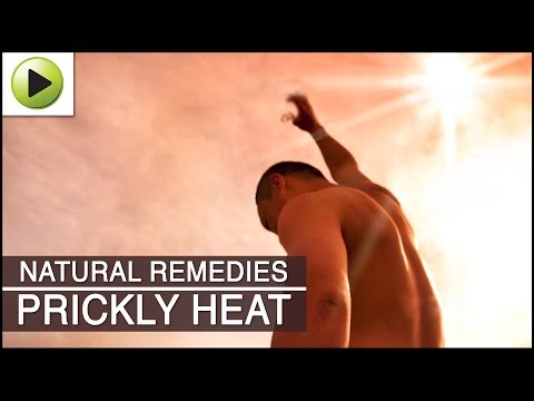 how to get rid prickly heat