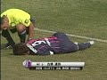古橋達弥、湘南戦gk金永基と接触し脳震盪