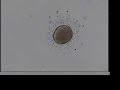 fertilization of sanddollar eggs