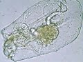 Rotifer, Asplanchna brightwelli.wmv