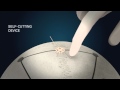 Cranial LOOP (L) at work