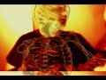 Cattle Decapitation "A Body Farm" (OFFICIAL VIDEO) - free flv video @ vwatch.tv