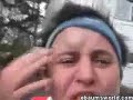 Kid nailed in forehead with hammer Kid nailed in forehead with hammer