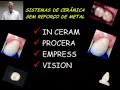 Aula teórica de Metal Free - In Ceram