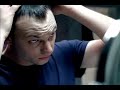 FX Nip/Tuck - Hair Plugs