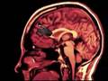 A journey through the brain's wiring A journey through the brain's wiring