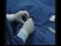 Puncion Arterial Femoral Puncion Arterial Femoral
