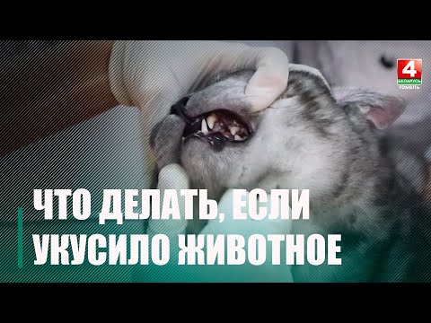 Специалист рассказала, как поступить при укусе животного видео