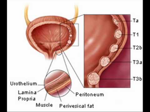 how to control urine infection
