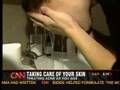 Acne from Dr. Howard Brooks