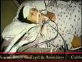 California Medical Malpractice Attorney Birth injury News