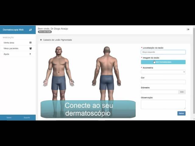 Dermatologia Web – Software para Dermatoscopia Digital