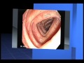 Endoscopia Gastrointestinal