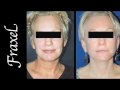 Dr. Rita Rakus - Cosmetic Surgery in London