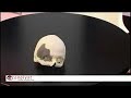 Arcam - Electron Beam Melting