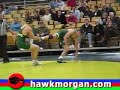 Fig 4 Head Scissors