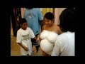 Belly Cast