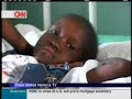 Tanzanian Cancer Hospital Battles Odds to Save Lives