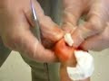 Toenail Removal Torture!!