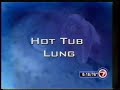 NTM lung disease affects a rapidly growing number of people. This mostly female population across the United States needs our help.