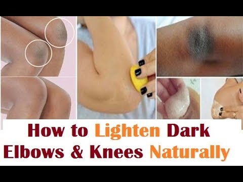 how to whiten knee and elbow naturally