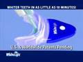 top rated teeth whitening products