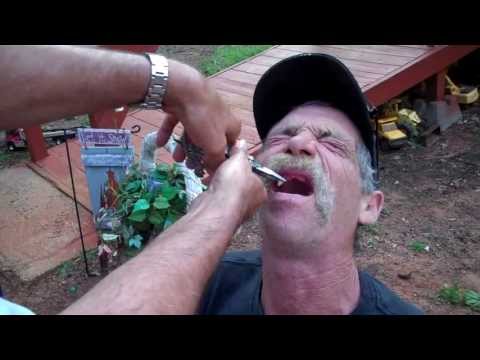 TOOTH!! - A friend of mine had a bad toothache, and wanted to drive 2 hrs into Dallas to get his tooth pulled. I told him I had pliers and some Jack Daniels and could ...