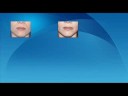Anti Aging Skin Care