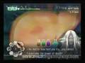 Second Opinion X.4 XS Many Misses Guide (Naomi)